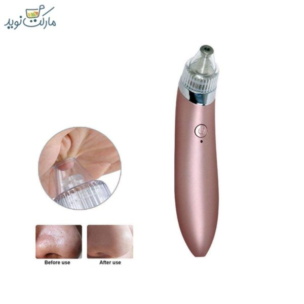 دستگاه پاکسازی پوست میکرودرم ۸۰۳۰